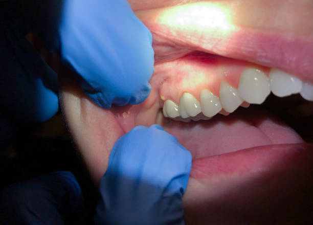 Best Same-Day Emergency Dentist in Napavine, WA